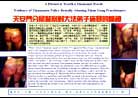 Published on 2/15/2001 Falun Gong practitioners suffer cruel torture from Tiananmen police.