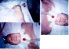 Published on 12/16/2000 Zhao Xin is the woman who had three of her vertebrae crushed while in police custody. 