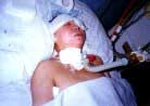 Published on 12/16/2000 Zhao Xin is the woman who had three of her vertebrae crushed while in police custody. 