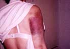 Published on 1/1/2001 The photos above show that a Falun Dafa practitioner was brutally beaten by police in Tiananmen Square on December 26, 2000. Her right arm was beaten to the point that it can no longer move.  