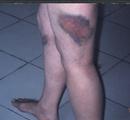 Published on 3/16/2001 On February 2001, a practitioner went to Tiananmen Square to appeal for Falun Dafa. He was then brutally beatened by Tiananmen police, the photos shows wounds in his body. 