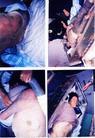 Published on 7/5/2003 Ms. Xiong Fengxia, a Dafa practitioner in Baoding City, Hebei Province, was tortured to death at Liyuzhuang Brainwashing Center, Dingxing County in mid-October, 2002. Her family found more than 40 wounds and bruises in her body, the photos show some wounds in her body. 