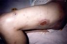 Published on 8/20/2003 Police beat a six months pregnant Dafa practitioner with a wooden rod.