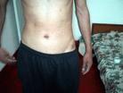 Published on 9/10/2003 Photo evidence: scars resulted from police torture. 