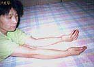 Published on 9/20/2000 Yi, XingQin - born on February 16, 1965, living in Dalian city.

Arrested on August 30, 1999, she was chained at about 11 pm on September 8 to the window bars in the hallway, and forced to stand there until 8pm the next day, for a total of 21 hours. In the evening of September 9, she was chained back to back with another practitioner. They were forced to stand until 8pm of the 10th, then were separated and individually chained with their hands cuffed in the back until 9 am of the 14th when she was forced to work with handcuffs removed until 9 pm that night, then chained again. This went on until she was released on 15th at noontime. Her hands have obvious scars as shown in the photo. 