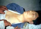 Published on 10/16/2001 Falun Dafa practitioner Mr. Wang Yongdong was beaten to death in his own home and his body was thrown from the fourth floor on  September 21, 2001.
