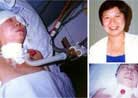 Published on 2000 Falun Dafa practitioner Ms. Zhao Xin, 32, suffered three fractured vertebrae from police brutality, and died on December 13, 2000.