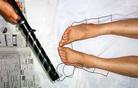 Published on 9/18/2004 Prison guards insert needles connected by wires to an electric baton into the victim’s acupuncture points or other sensitive areas. At high voltages, the victim is jolted into the air causing the entire body to convulse. Those with heart problems often died.