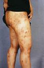 Published on 10/11/2001 Scars left in a practitioner’s body due to torture suffered in Wanjia Labor Camp in  Harbin.