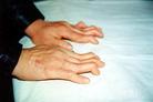 付丽(黑龙江)41岁，2000年被哈尔滨市万家劳教所折磨得双手残疾，全身疮疤