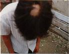 山东安丘学员　2004年9月4日，大片头发被贾戈派出所贾宝臣等恶警活活撕下