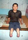 		邹砚杰(吉林) 2002年2月，被哈拉海镇派出所王世权、张恩峰等迫害致双腿截肢并流离失所