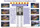 Published on 2/15/2001 洪法图片：血铸的铁证――法轮功学员遭受的酷刑伤害

