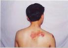 Published on 3/5/2004 Photo Evidence of How the Dalian Development District Police Tortured Falun Dafa Practitioner Mr. Li Zhongmin, Who Died One Year Ago
