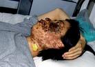 Published on 7/7/2004 Ms. Gao Rongrong’s Face Is Severely Disfigured by Seven Hours of Electric Baton Torture in the Longshan Labor Camp