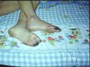 Published on 3/8/2001 图片：被警察强迫而冻坏的下肢
