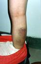 5/24/2001发表.照片：河北大法弟子被毒打的证据
