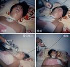 8/3/2003发表.妹被折磨瘫痪　姐遭刑讯致残──河北省610歹徒暴行（图）
