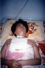 Published on 8/3/2003 妹被折磨瘫痪　姐遭刑讯致残──河北省610歹徒暴行（图）
