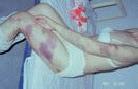 Published on 6/8/2001 几位弟子被毒打的伤痕照片
